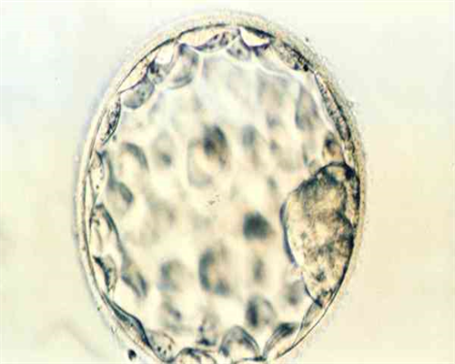 创博代孕费用_高鹰代生双胞胎价格,试管婴儿移植后腹痛是怎么回事？移植后便
