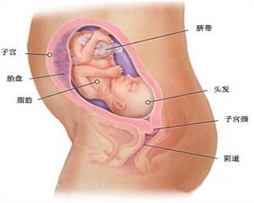 多囊这样调理怀上双胞胎，已有胎心胎压，全家