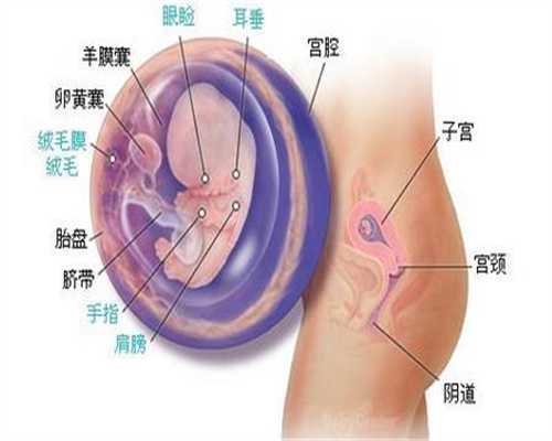 间质部妊娠和宫角妊娠如何鉴别可不都是异位妊