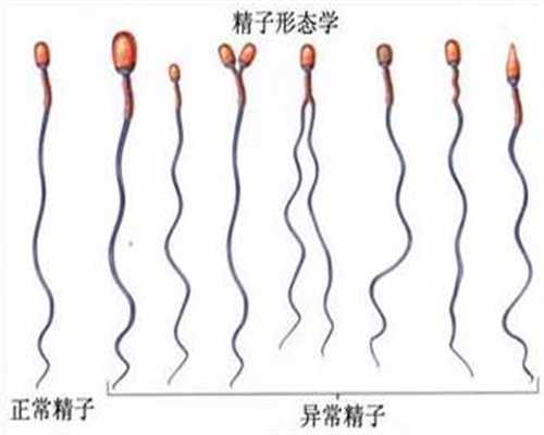 深圳有代孕的吗：孕妇梦见蛇是什么意思