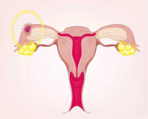周口试管代孕：兰州24岁的身体装着50岁的卵巢咋