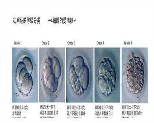 上海代孕公司,输卵管造影检查结果正常，为什么