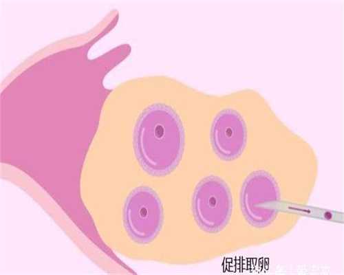 中国哪有重庆代孕,代孕三个月肚子多大胎儿算是