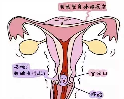 广州代孕哪里好-广州代孕手术费用咨询-孕妇不能吃的高糖水果的原因是什么