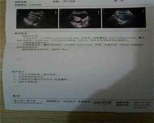 广州代孕生子多少钱_广州代孕的医院_广州请人代孕需多少钱