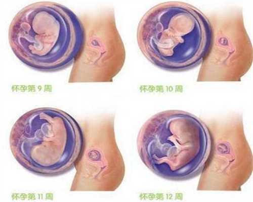 广州代孕生男孩-中药调理体质要多久(一助孕包生男孩费用般中药调理要多久
